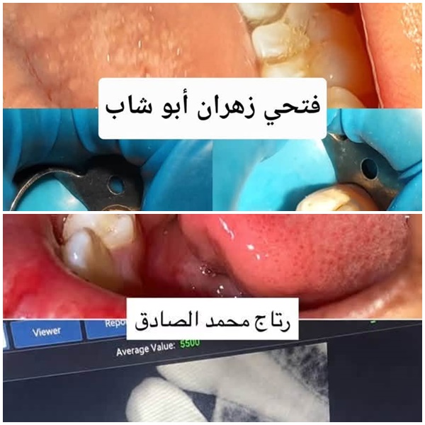 التدريب العملي لطلبة السنة الرابعة طب اسنان للعام الجامعي 2025-2026